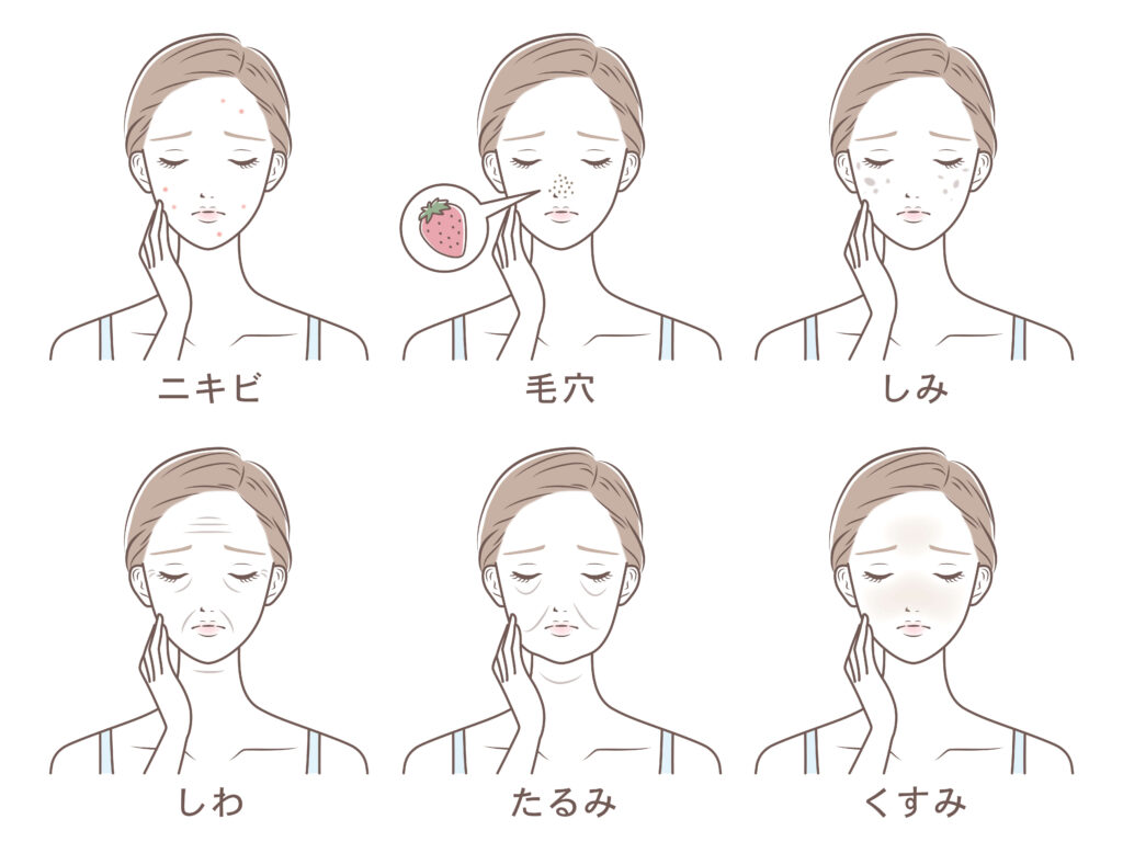 女性の肌悩み